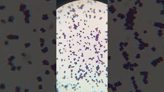 Micrococcus in urine culture culture microbiology bacteria gramstaining [upl. by Pedaias]