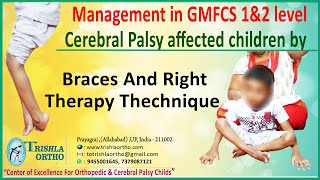 3 Teaching Standing Balance Pediatric Physical Therapy for a Child with Moderate Cerebral Palsy [upl. by Yrallih]