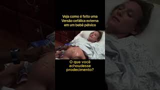 Versão cefálica de bebê pélvico gestacao maternidade partohumanizado [upl. by Einahpetse996]