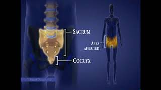 Spinal Cord Injuries I Areas Affected by Level of Injury [upl. by Gusta]