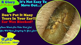 Why Your Ear Not Hear Anything  New Video Ear Wax Removal 1064 [upl. by Garrot66]