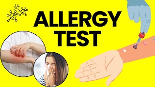 What Is An Allergy Test Procedure Side Effects Precautions amp Reports [upl. by Oria904]