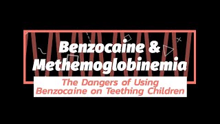 Benzocaine Dangers amp Teething  Methemoglobinemia  Family Dentistry  Downers Grove Illinois [upl. by Oneida]