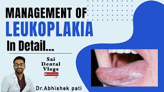 MANAGEMENT OF LEUKOPLAKIA IN DETAIL [upl. by Claman24]