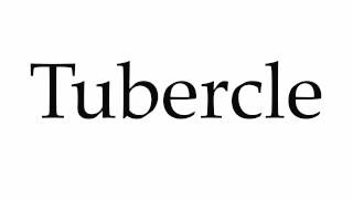 How to Pronounce Tubercle [upl. by Elvina]