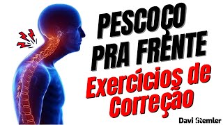 PESCOÇO PRA FRENTE Exercícios de Correção  Davi Stemler [upl. by Starlene]