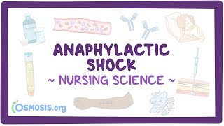 Anaphylactic shock Clinical Nursing Care [upl. by Khai]