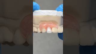 Lateral Nesbit ​⁠EnvisiontecMain envisiontec lsk121shorts dentist teeth [upl. by Namus]