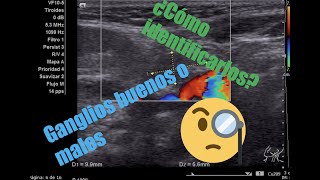 Adenopatías cervicales en niñosDr Daniel Flores [upl. by Adiaroz]