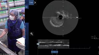 Learn From The Masters  Managing Calcified Bifurcation Coronary Lesions June 2024 [upl. by Aibar869]