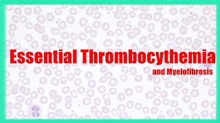 Essential Thrombocythemia and Myelofibrosis  WBC disorders  Usmle Hematology speedymedicalusmle [upl. by Ahseken]