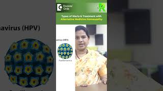 Are WARTS CONTAGIOUS Warts Homeopathy Alternative Medicine CureDrV BhagyalakshmiDoctors Circle [upl. by Ube]