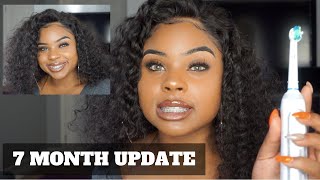 7 MONTH BRACES UPDATE  SPACERS AND ORAL B GENIUS PRO TOOTHBRUSH [upl. by Irena]