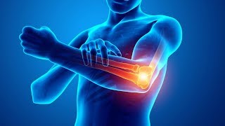 Tennis Elbow Symptoms and Proven Treatment [upl. by Bentley]