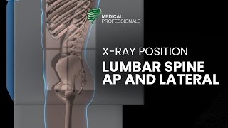 Radiographic Positioning Lumbar Spine AP and Lateral [upl. by Ut]