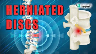 Herniated Discs  Causes amp Solutions 🤯🚨🥺🔥 [upl. by Simpson]