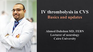 IV thrombolysis in AIS  basics and updates  DrAhmed Dahshan [upl. by Thayne]