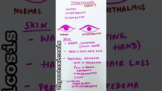 Thyrotoxicosis  Graves disease  Heat intolerance [upl. by Akenet845]