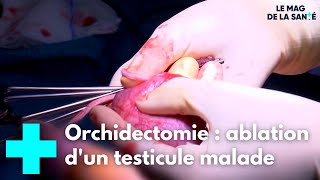 Orchidectomie  une opération pour retirer le testicule malade  Le Magazine de la Santé [upl. by Enawd]