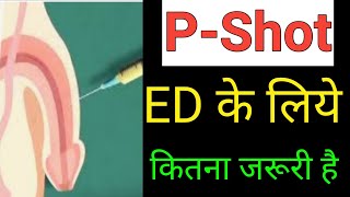 PShot for EDPRP treatment ke fayde aur nuksaanकरवाने से पहले ये वीडियो जरूर देख लेना।। [upl. by Dlarej]