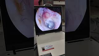 Endoscopic camera unit my whatsapp number 9879223281 [upl. by Norri747]