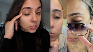 My Chalazion Experience 3x Story time  Products I use [upl. by Davenport539]