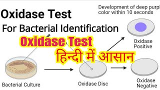 Oxidase test in hindi  Bacterial identification  Microbiology [upl. by Airdnaid]