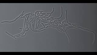 Multiple fission in Corynebacterium matruchotii [upl. by Silva]