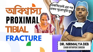 IMMENSE Recovery From Proximal Tibia Fracture in KolkataBest Orthopedic Surgeon Dr Nirmalya Deb [upl. by Neelear348]