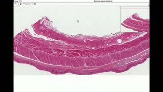 Anatomy  Histology of the Esophagus [upl. by Ahsinam88]