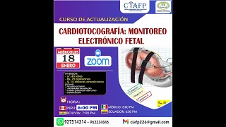 🔴𝗖𝗨𝗥𝗦𝗢 DE ACTUALIZACIÓN 👉CARDIOTOCOGRAFÍA MONITOREO ELECTRÓNICO FETAL [upl. by Melliw736]