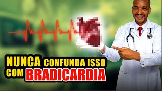 O QUE NAO É BRADICARDIA [upl. by Lusty]