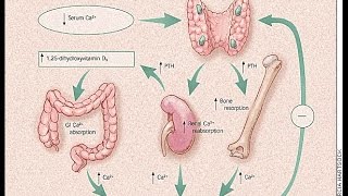 Hyperparathyroidism [upl. by Lawrence]