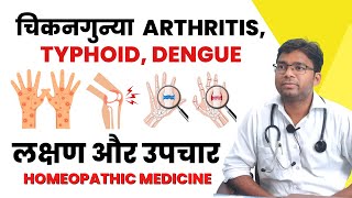 Chikungunya Arthritis Typhoid Dengue  लक्षण और उपचार  Homeopathic Medicine drneeraj [upl. by Fe47]