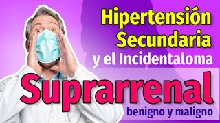 Hipertensión secundaria e Incidentalomas suprarrenales  Cap 98 y 99  Dr Mario Vega Carbó [upl. by Sammons]