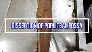 Dissection of Popliteal Fossa [upl. by Naresh]