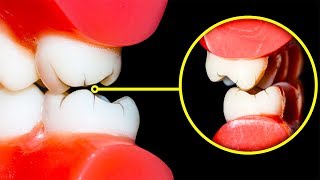 How to Stop Grinding Your Teeth at Night [upl. by Bengt467]