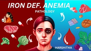 iron deficiency anemia part 1  must watch video for mbbs [upl. by Sallyanne]