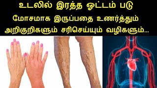 SymptomsCauses and How to Improve Blood Circulation in Tamil  Rahul Health tips in Tamil [upl. by Reeve]