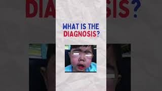 Paediatric Exam Spot Diagnosis 2 l 3 year old boy l mrcpch usmle medicalschool [upl. by Alister]