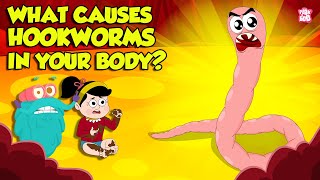 What causes Hookworm। Intestinal Worms Symptoms and Treatment  Worm Infection  Dr Binocs Show [upl. by Anatniuq355]