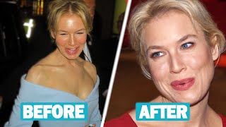 Renée Zellweger Plastic Surgery and Weight Loss Journey [upl. by Oberstone259]