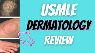 Everything you need to know about Dermatology for the USMLE [upl. by Corrie]