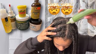 DIY GREASE FOR EXTREME HAIR GROWTH [upl. by Tarttan]