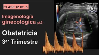 123  Imagen en Obstetricia 3er Trimestre [upl. by Nessnaj]