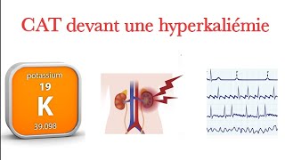 CAT devant hyperkaliémie [upl. by Sander641]