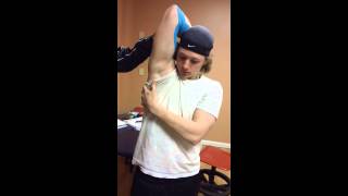 Pain in Elbow Baseball Player Kinesio Taping [upl. by Luapnaej]