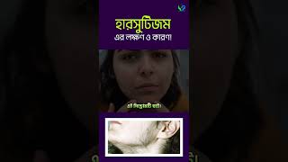 হারসুটিজম এর লক্ষণ এবং কারণসমুহ । Hirsutism [upl. by Leroy]