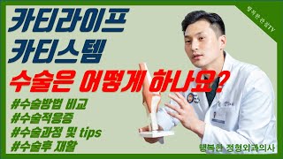 무릎연골재생카티라이프와 카티스템 비교분석 해드립니다 카티라이프 카티스템 수술 어떻게 하는지 수술과정은 어떠한지 알려드립니다 [upl. by Asiled]