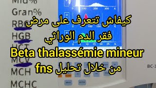 كيفاش تتعرف على مرض فقر الدم الوراثي beta thalassémie mineur من تحليل fns [upl. by Yeldah]